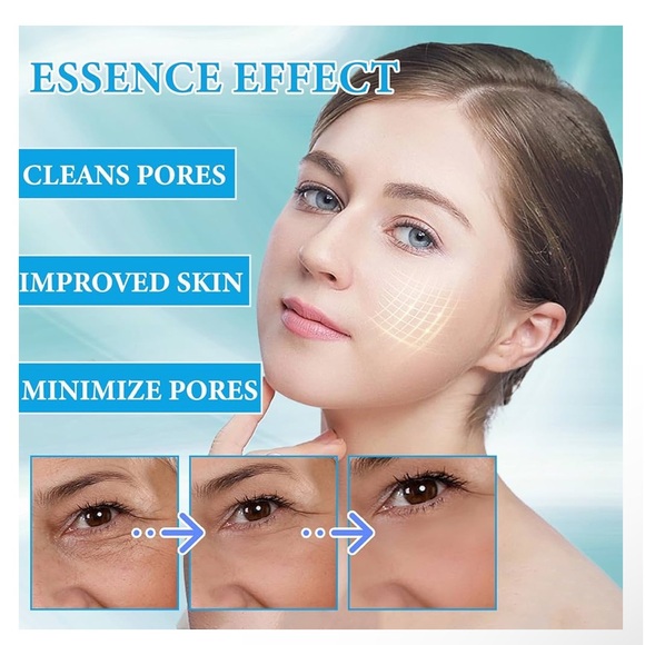 T-17: Lot of 4 Botox Stock Solution Facial Serum - Picture 5 of 7